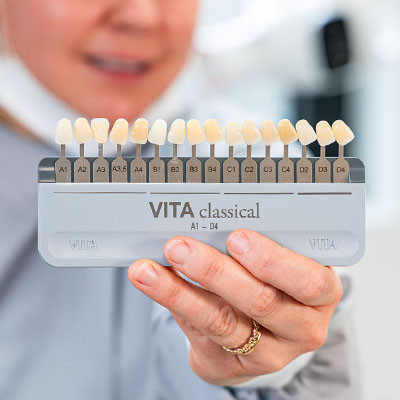 Spécialistes en esthétique dentaire à Molenbeek | VOCLIdental